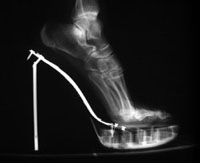 Stiletto x-ray